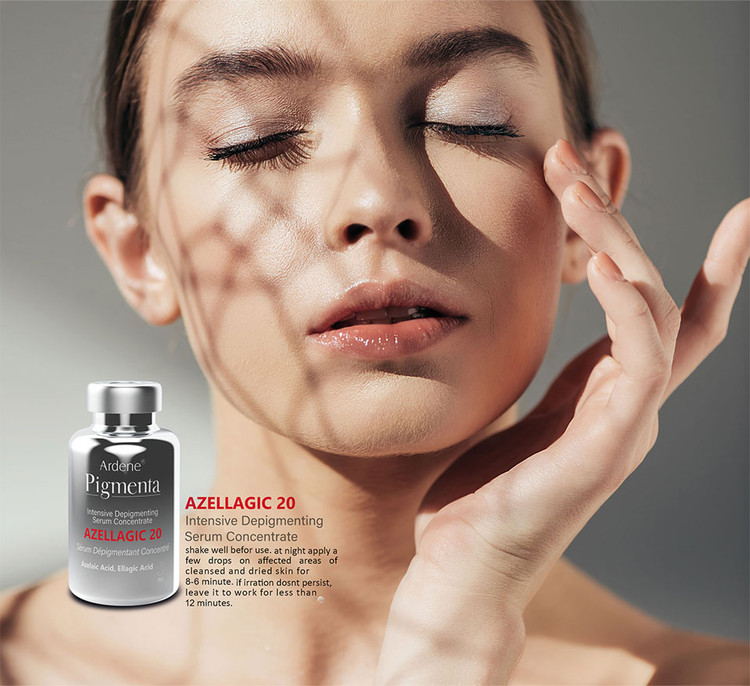 سرم کنسانتره ضدلک و روشن کننده قوی پیگمنتا آردن AZELLAGIC 20